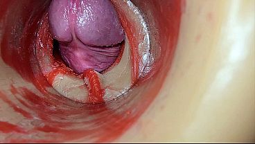 Female Insemination – Internal Camera Captures Deep Male Huge Ejaculation